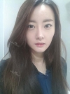 Eye, Nose, Micro Fat Grafting, Facial bone contouring surgery — Korea cost, reviews & before-after | MISOODA