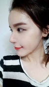 Eye, Nose, Micro Fat Grafting surgery real reviews! — Korea cost, reviews & before-after | MISOODA