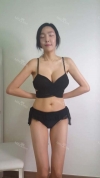 My face looks perfectly normal now — Korea cost, reviews & before-after | MISOODA