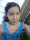 My face looks perfectly normal now — Korea cost, reviews & before-after | MISOODA