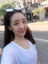 Eye, Nose, Micro Fat Grafting, Facial bone contouring surgery! — Korea cost, reviews & before-after | MISOODA