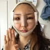 Eye, Nose, Micro Fat Grafting, Facial bone contouring surgery! — Korea cost, reviews & before-after | MISOODA