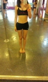 body, breast surgery — Korea cost, reviews & before-after | MISOODA