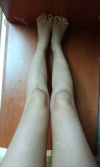 body, breast surgery — Korea cost, reviews & before-after | MISOODA