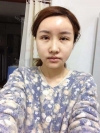 Eye, Nose, Micro Fat Grafting, Facial bone contouring surgery~! — Korea cost, reviews & before-after | MISOODA