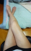 body, breast surgery — Korea cost, reviews & before-after | MISOODA