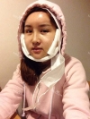 Eye, Nose, Micro Fat Grafting, Facial bone contouring surgery~! — Korea cost, reviews & before-after | MISOODA