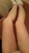 breast, body, calf high frequency — Korea cost, reviews & before-after | MISOODA