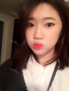 Two-jaw + Ar + Zy + T + Front zygoma(sil) + forehead (sil) + calibration O (ceramic) — Korea cost, reviews & before-after | MISOODA