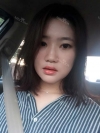 Two-jaw + Ar + Zy + T + Front zygoma(sil) + forehead (sil) + calibration O (ceramic) — Korea cost, reviews & before-after | MISOODA