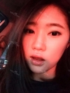 Two-jaw + Ar + Zy + T + Front zygoma(sil) + forehead (sil) + calibration O (ceramic) — Korea cost, reviews & before-after | MISOODA