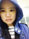 Two-jaw + Ar + Zy + T + Front zygoma(sil) + forehead (sil) + calibration O (ceramic) — Korea cost, reviews & before-after | MISOODA