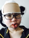 Two-jaw + Ar + Zy + T + Front zygoma(sil) + forehead (sil) + calibration O (ceramic) — Korea cost, reviews & before-after | MISOODA