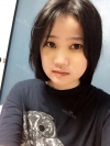 Two-jaw + Ar + Zy + T + Front zygoma(sil) + forehead (sil) + calibration O (ceramic) — Korea cost, reviews & before-after | MISOODA