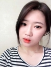 Two-jaw + Ar + Zy + T + Front zygoma(sil) + forehead (sil) + calibration O (ceramic) — Korea cost, reviews & before-after | MISOODA