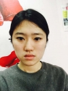 Two-jaw + Ar + Zy + T + Front zygoma(sil) + forehead (sil) + calibration O (ceramic) — Korea cost, reviews & before-after | MISOODA