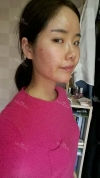 Eye, Nose, 3DCT-V-line Rectangular Jaw, Accessory Breast Removal, Micro Fat Grafting — Korea cost, reviews & before-after | MISOODA