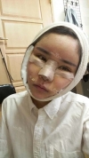 Eye, Nose, 3DCT-V-line Rectangular Jaw, Accessory Breast Removal, Micro Fat Grafting — Korea cost, reviews & before-after | MISOODA