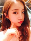 Ni (ptosis) + Epi + Tr + Rhino (re) Nasal septum + Rt Ear cartilage — Korea cost, reviews & before-after | MISOODA