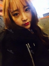 Ni (ptosis) + Epi + Tr + Rhino (re) Nasal septum + Rt Ear cartilage — Korea cost, reviews & before-after | MISOODA