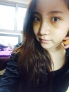 Ni (ptosis) + Epi + Tr + Rhino (re) Nasal septum + Rt Ear cartilage — Korea cost, reviews & before-after | MISOODA