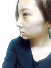 Ni (ptosis) + Epi + Tr + Rhino (re) Nasal septum + Rt Ear cartilage — Korea cost, reviews & before-after | MISOODA