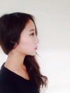 Ni (ptosis) + Epi + Tr + Rhino (re) Nasal septum + Rt Ear cartilage — Korea cost, reviews & before-after | MISOODA