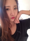 Ni (ptosis) + Epi + Tr + Rhino (re) Nasal septum + Rt Ear cartilage — Korea cost, reviews & before-after | MISOODA