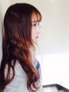 Ni (ptosis) + Epi + Tr + Rhino (re) Nasal septum + Rt Ear cartilage — Korea cost, reviews & before-after | MISOODA
