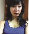 The most natural and suitable size for me! — Korea cost, reviews & before-after | MISOODA