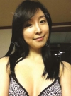 The most natural and suitable size for me! — Korea cost, reviews & before-after | MISOODA