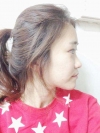 Two jaw + Ar + Zy + T + Ni + Lat + Bottom + Epi + Rhino + F/g — Korea cost, reviews & before-after | MISOODA