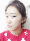 Two jaw + Ar + Zy + T + Ni + Lat + Bottom + Epi + Rhino + F/g — Korea cost, reviews & before-after | MISOODA