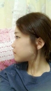 Two jaw + Ar + Zy + T + Ni + Lat + Bottom + Epi + Rhino + F/g — Korea cost, reviews & before-after | MISOODA