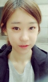Two jaw + Ar + Zy + T + Ni + Lat + Bottom + Epi + Rhino + F/g — Korea cost, reviews & before-after | MISOODA