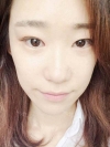 Two jaw + Ar + Zy + T + Ni + Lat + Bottom + Epi + Rhino + F/g — Korea cost, reviews & before-after | MISOODA