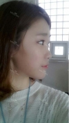 Two jaw + Ar + Zy + T + Ni + Lat + Bottom + Epi + Rhino + F/g — Korea cost, reviews & before-after | MISOODA