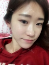 Two jaw + Ar + Zy + T + Ni + Lat + Bottom + Epi + Rhino + F/g — Korea cost, reviews & before-after | MISOODA