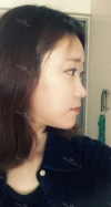 Two jaw + Ar + Zy + T + Ni + Lat + Bottom + Epi + Rhino + F/g — Korea cost, reviews & before-after | MISOODA