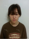 Two jaw + Ar + Zy + T + Ni + Lat + Bottom + Epi + Rhino + F/g — Korea cost, reviews & before-after | MISOODA