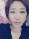 Two jaw + Ar + Zy + T + Ni + Lat + Bottom + Epi + Rhino + F/g — Korea cost, reviews & before-after | MISOODA