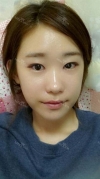 Two jaw + Ar + Zy + T + Ni + Lat + Bottom + Epi + Rhino + F/g — Korea cost, reviews & before-after | MISOODA