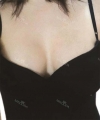 Suitable size makes me look perfect — Korea cost, reviews & before-after | MISOODA