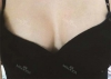 Suitable size makes me look perfect — Korea cost, reviews & before-after | MISOODA