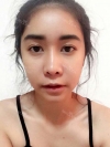 A Gift of Dream / The Perfect Facial Line... — Korea cost, reviews & before-after | MISOODA