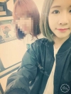 More natural, more Beautiful. The harmony of facial features! — Korea cost, reviews & before-after | MISOODA