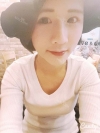More natural, more Beautiful. The harmony of facial features! — Korea cost, reviews & before-after | MISOODA