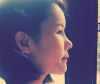 More natural, more Beautiful. The harmony of facial features! — Korea cost, reviews & before-after | MISOODA