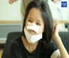 More natural, more Beautiful. The harmony of facial features! — Korea cost, reviews & before-after | MISOODA
