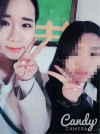 More natural, more Beautiful. The harmony of facial features! — Korea cost, reviews & before-after | MISOODA